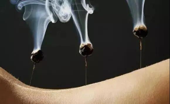 艾灸不是藥，調(diào)的不是病，央視為艾灸正名，讓我們正視艾灸