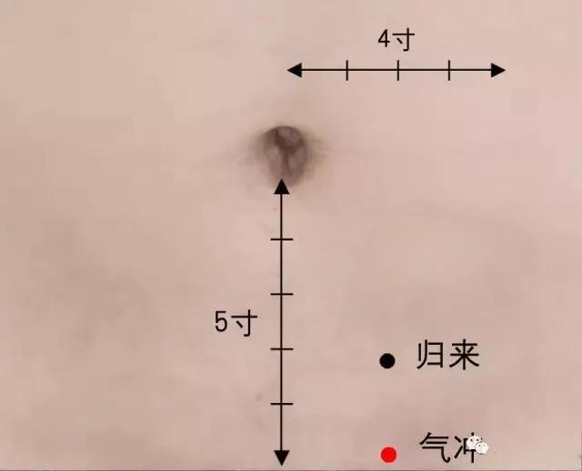 　一艾灸就上火，這是為什么?