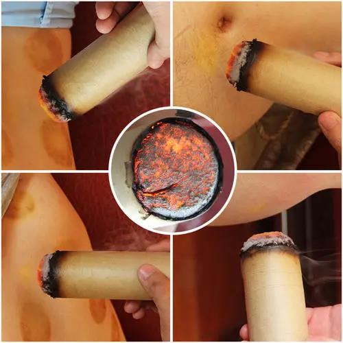 灸溫，到底是燙的好還是溫的好？為什么有的人感覺不到熱?