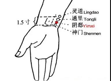 睡覺愛出汗，艾灸這幾個穴位