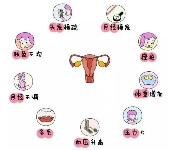 10個(gè)女人就有1個(gè)患多囊！被它纏上不要怕，艾灸幫你調(diào)“多囊”！